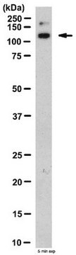 Anti-Integrin alpha 10 (ITGA10) Antibody from rabbit, purified by affinity chromatography