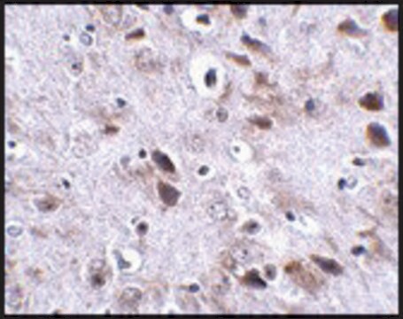 Anti-TMEM18 antibody produced in rabbit affinity isolated antibody, buffered aqueous solution