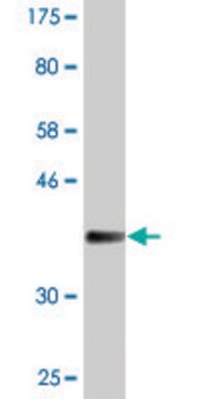 Monoclonal Anti-UMOD antibody produced in mouse clone 3F10, purified immunoglobulin, buffered aqueous solution