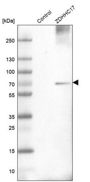 Anti-ZDHHC17 antibody produced in rabbit Prestige Antibodies&#174; Powered by Atlas Antibodies, affinity isolated antibody, buffered aqueous glycerol solution