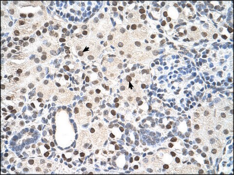 Anti-PSME3 (AB1) antibody produced in rabbit affinity isolated antibody