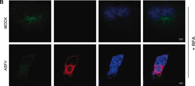 Monoclonal Anti-&#947;-Adaptin antibody produced in mouse clone 100/3, ascites fluid