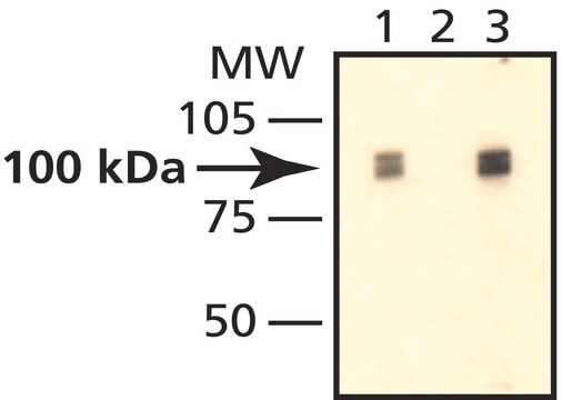 Anti-PM/Scl-100 antibody produced in rabbit ~1.0&#160;mg/mL, affinity isolated antibody, buffered aqueous solution