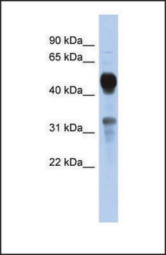 Anti-MVK antibody produced in rabbit affinity isolated antibody