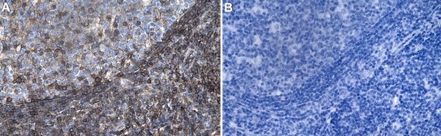 Anti-HLA-A Antibody, clone 2K7 ZooMAb&#174; Rabbit Monoclonal recombinant, expressed in HEK 293 cells