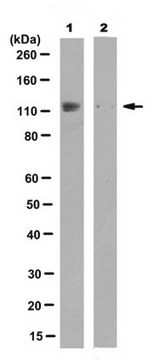 Anti-phospho-ULK1 (Ser 467), clone 15D12.3 Antibody clone 15D12.3, from mouse