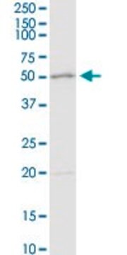 Anti-ADA antibody produced in rabbit purified immunoglobulin, buffered aqueous solution