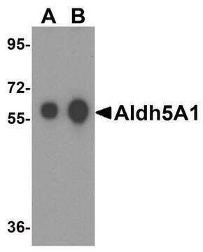 Anti-ALDH5A1 antibody produced in rabbit affinity isolated antibody, buffered aqueous solution