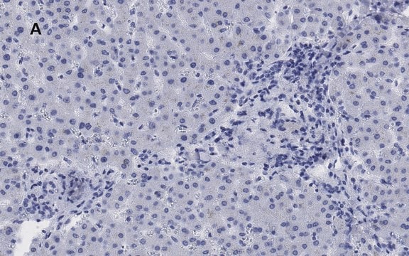 Anti-LDL Receptor Antibody, clone 2N19, ZooMAb&#174; Rabbit Monoclonal recombinant, expressed in HEK 293 cells