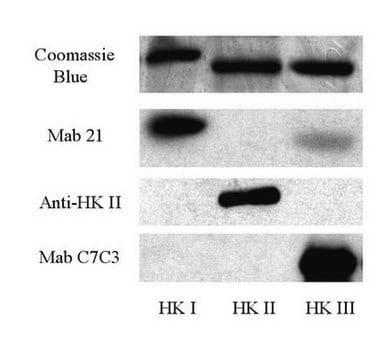 Anti-Hexokinase Type II Antibody Chemicon&#174;, from rabbit