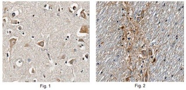 Anti-CORO1A Antibody, clone 2E11.2 clone 2E11.2, from mouse