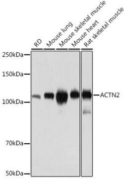 Anti-ACTN2 Antibody, clone 2P7E6, Rabbit Monoclonal