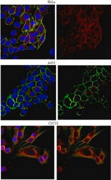 Anti-EEA1 Antibody from rabbit, purified by affinity chromatography