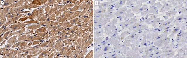 Anti-MYH6 Antibody, clone 1L5 ZooMAb&#174; Rabbit Monoclonal recombinant, expressed in HEK 293 cells