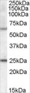 Anti-COL4A3BP (AA 662-672) antibody produced in goat affinity isolated antibody, buffered aqueous solution