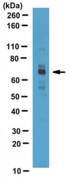 Anti-CPT2 Antibody serum, from rabbit