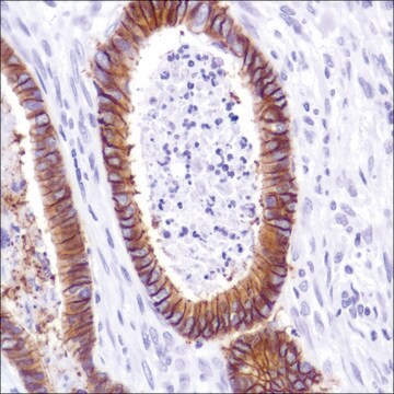 Anti-Cadherin -17 antibody, Rabbit monoclonal recombinant, expressed in proprietary host, clone SP183, affinity isolated antibody