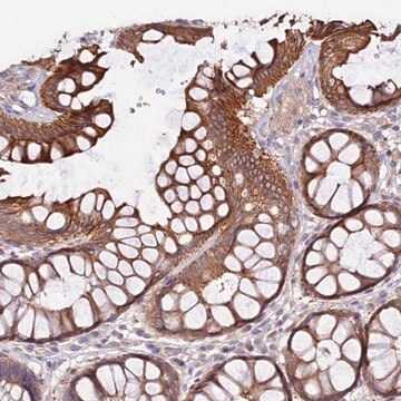 Anti-VPS11 antibody produced in rabbit Prestige Antibodies&#174; Powered by Atlas Antibodies, affinity isolated antibody, buffered aqueous glycerol solution