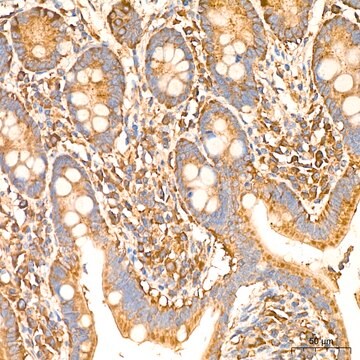 Anti-IL11RA Antibody, clone 10Z3S9, Rabbit Monoclonal