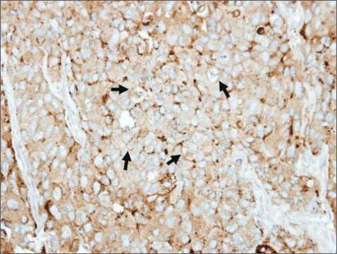 Anti-LAMP2 antibody produced in rabbit