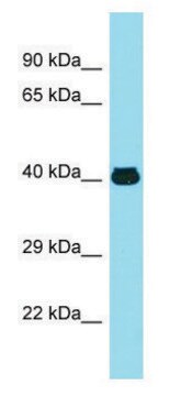 Anti-MFSD2A (N-terminal) antibody produced in rabbit affinity isolated antibody