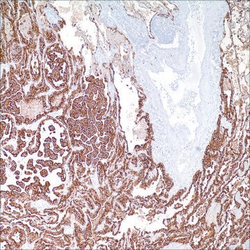 Cytokeratin 7 (OV-TL 12/30) Mouse Monoclonal Antibody