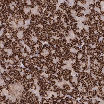 Anti-TGFBRAP1 antibody produced in rabbit Prestige Antibodies&#174; Powered by Atlas Antibodies, affinity isolated antibody, buffered aqueous glycerol solution