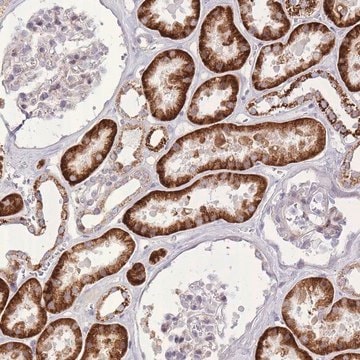 Anti-SLC4A4 antibody produced in rabbit Prestige Antibodies&#174; Powered by Atlas Antibodies, affinity isolated antibody, buffered aqueous glycerol solution