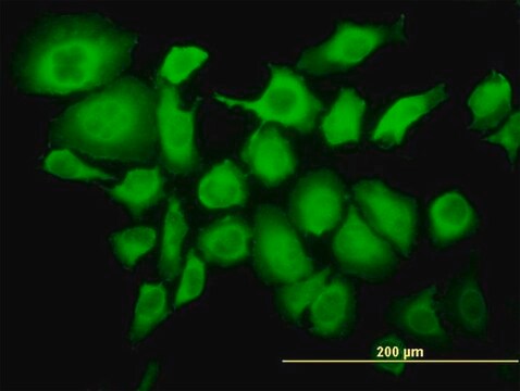 ANTI-TRIM25 antibody produced in mouse clone 5F12, purified immunoglobulin, buffered aqueous solution