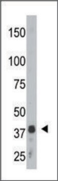 Anti-SULT2B1a/b (N-term) antibody produced in rabbit IgG fraction of antiserum, buffered aqueous solution