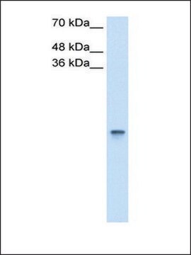 Anti-RBP1 antibody produced in rabbit IgG fraction of antiserum