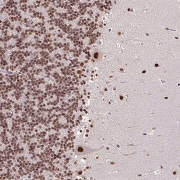 Anti-TDG antibody produced in rabbit Prestige Antibodies&#174; Powered by Atlas Antibodies, affinity isolated antibody, buffered aqueous glycerol solution