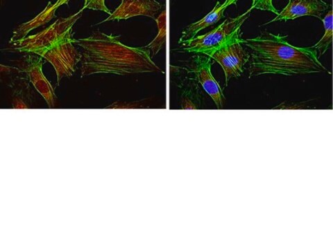 Anti-FOXO1 Antibody, clone 2H8.2 clone 2H8.2, from mouse