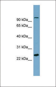 Anti-SEMA3D antibody produced in rabbit affinity isolated antibody