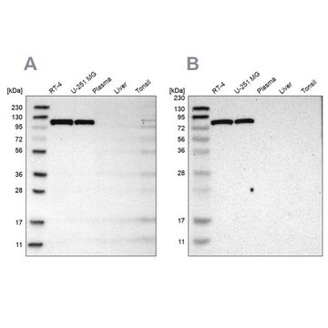 Anti-HK1 antibody produced in rabbit Prestige Antibodies&#174; Powered by Atlas Antibodies, affinity isolated antibody, buffered aqueous glycerol solution