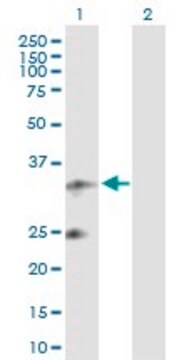 Anti-UQCRFS1 antibody produced in rabbit purified immunoglobulin, buffered aqueous solution