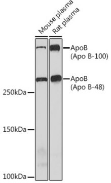 Anti-ApoB Antibody, clone 2T5X0, Rabbit Monoclonal