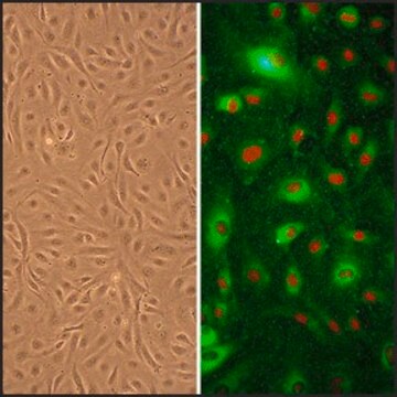 Human Umbilical Artery Endothelial Cells: HUAEC, neonatal