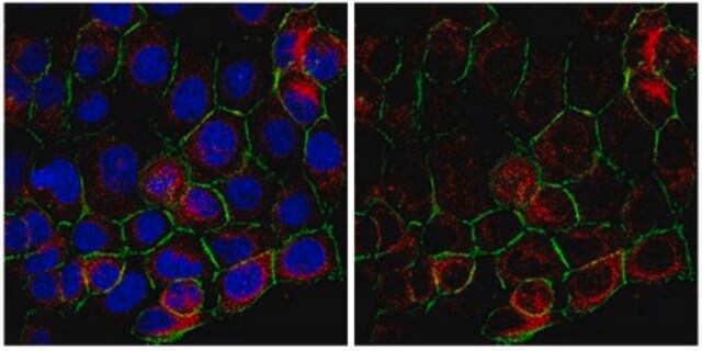 Anti-Tensin-3 Antibody from rabbit, purified by affinity chromatography