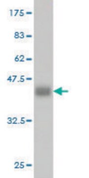 Monoclonal Anti-ADH4 antibody produced in mouse clone 3C5, purified immunoglobulin, buffered aqueous solution