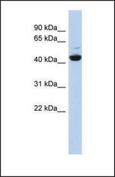 Anti-ATP6V1C1, (N-terminal) antibody produced in rabbit affinity isolated antibody