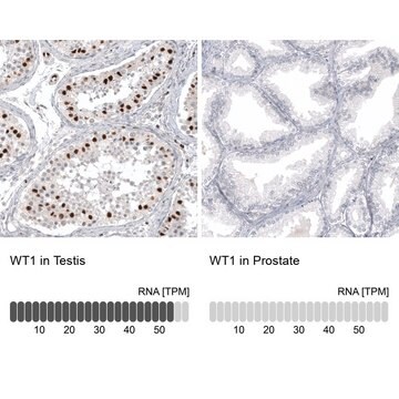 Anti-WT1 antibody produced in mouse Prestige Antibodies&#174; Powered by Atlas Antibodies, clone CL13176, purified by using Protein A, buffered aqueous glycerol solution