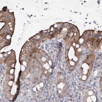 Anti-SCN11A antibody produced in rabbit Prestige Antibodies&#174; Powered by Atlas Antibodies, affinity isolated antibody, buffered aqueous glycerol solution