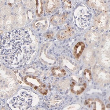 Anti-F13B antibody produced in rabbit Prestige Antibodies&#174; Powered by Atlas Antibodies, affinity isolated antibody, buffered aqueous glycerol solution