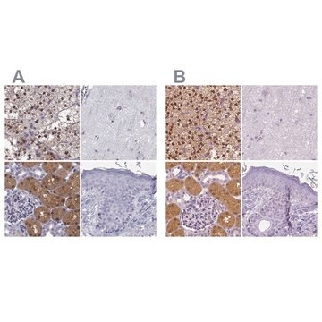 Anti-GALM Prestige Antibodies&#174; Powered by Atlas Antibodies, affinity isolated antibody