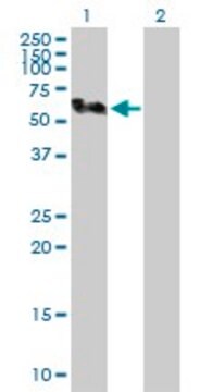 Anti-SMU1 antibody produced in rabbit purified immunoglobulin, buffered aqueous solution