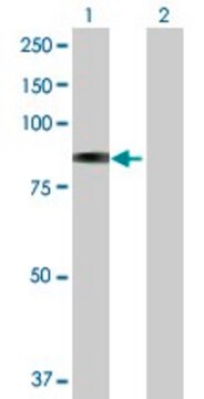 Anti-GLB1 antibody produced in rabbit purified immunoglobulin, buffered aqueous solution