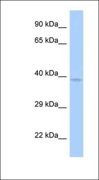 Anti-ANKRD9 antibody produced in rabbit affinity isolated antibody