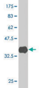 Monoclonal Anti-ACVR1B antibody produced in mouse clone 6D3, purified immunoglobulin, buffered aqueous solution