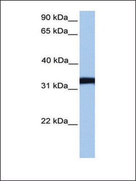 Anti-LDHC antibody produced in rabbit affinity isolated antibody